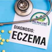 The-Real-CBD-CBd-mod-eksem Eczema diagnose fil med tabletter og stetoskop