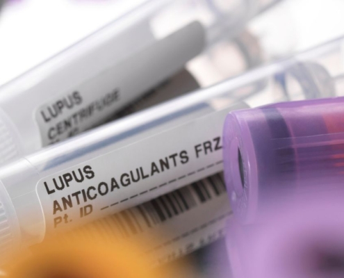 Rør til test af lupusvirus