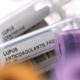 Rør til test af lupusvirus