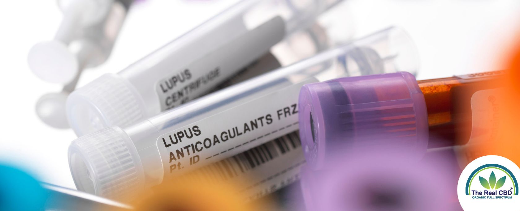 Rør til test af lupusvirus
