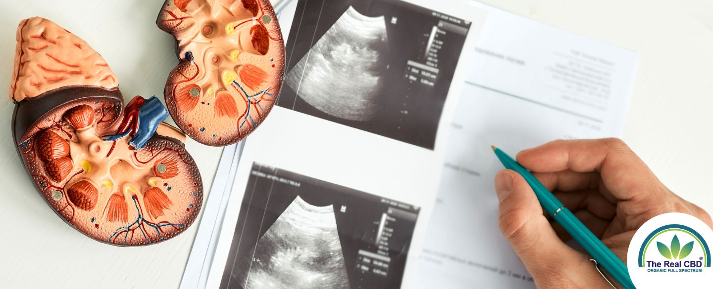 Scan billeder af nyrer med plastikmodeller af nyrer på siden