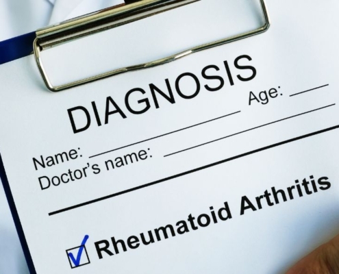 Læge holder clipboard med reumatoid arthritis-diagnose på