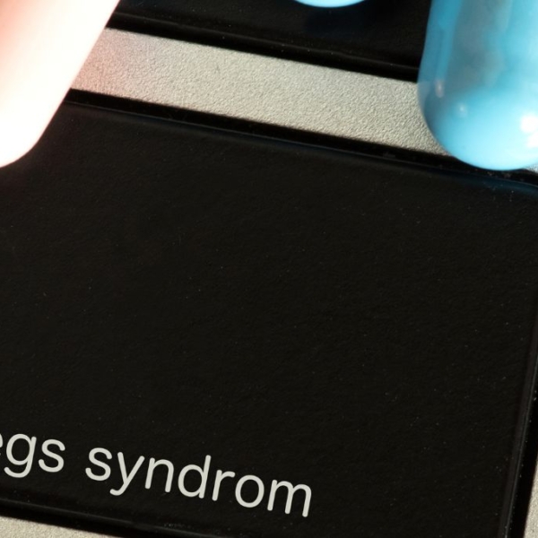 CBD mod Restless Leg Syndrome: En naturlig løsning