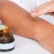 The-Real-CBD-Blog-kommer-CBD-salve-ind-i-dit-blodomløb Hånd, der gnider The Real CBD-balsam på armen