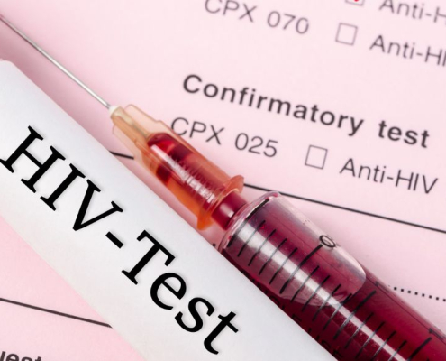 HIV blodtest på medicinske journaler