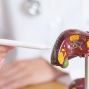 The-Real-CBD-blog-CBD-mod-hepatitis Læge forklarer Hepatitis til en patient ved hjælp ad en plastik lever model