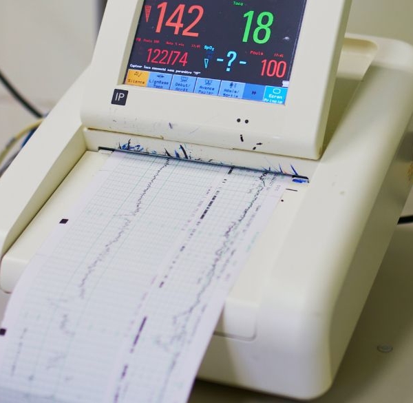 HRV monitor hos laegen