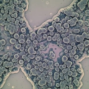 the-real-cbd-blog-CBD-til-svampe-infektioner Svamp set under et mikroscope