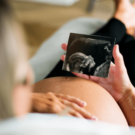 The-Real-CBD-blog-my-choice-to-use-CBD-while-pregnant (en anglais)