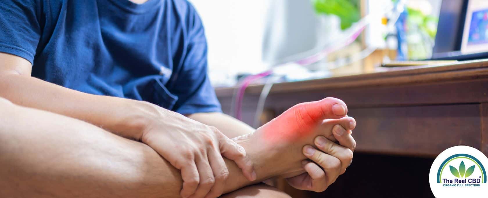 CBD Oil for Gout: An Unconventional but Potent Remedy
