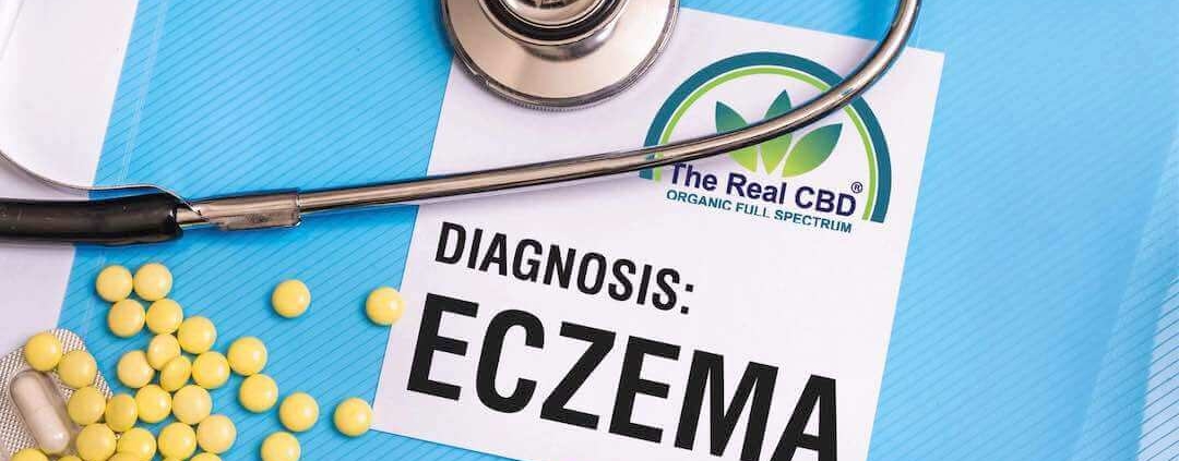 Carpeta sobre eczema en la consulta del médico