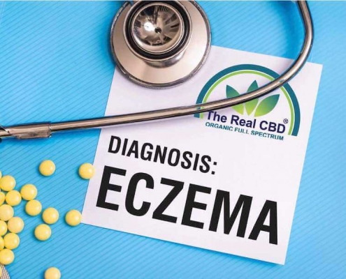 Carpeta sobre eczema en la consulta del médico