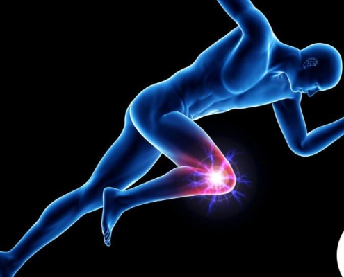 Ilustración de hombre corriendo con dolor de rodilla