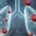 Pulmones con bacterias