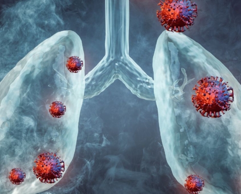 Pulmones con bacterias