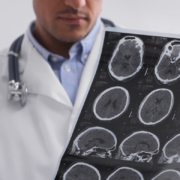 Los médicos hablan de un escáner cerebral