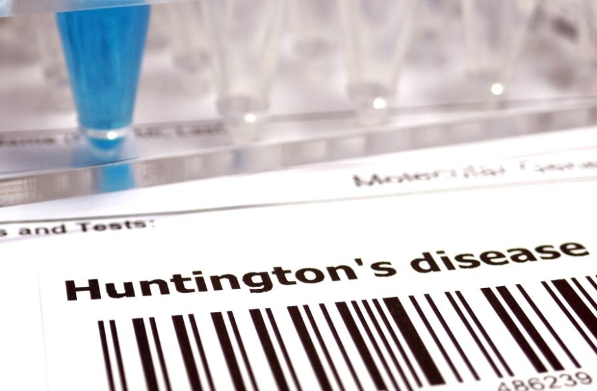 Informe médico sobre la enfermedad de Huntington