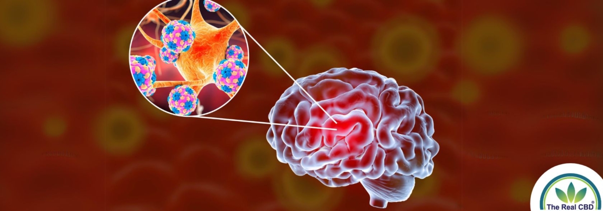 Ilustración de un cerebro y sus neuronas