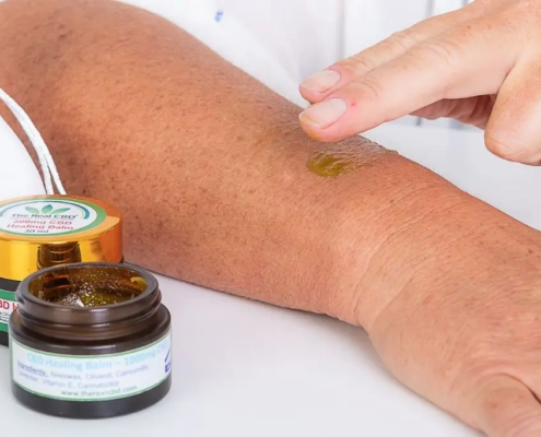 Mano aplicando bálsamo de CBD en el brazo
