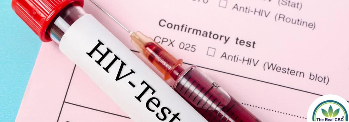 Análisis de sangre del VIH en las revistas médicas
