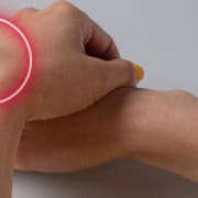 The-Real-CBD-CBD-para-lipoma Manos cruzadas con un lipoma en la muñeca