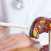 The-Real-CBD-blog-CBD-para-la-hepatitis Médico explicando Hepatits a un paciente utilizando un modelo de hígado