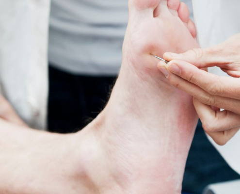 Médico comprobando la reacción nerviosa bajo los pies de un paciente