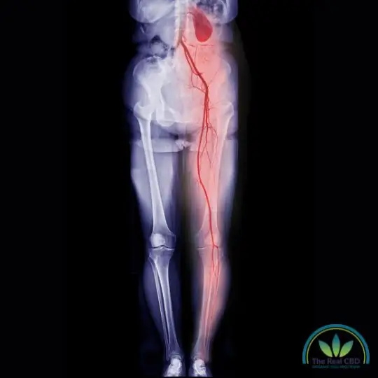 Venas del lado derecho en la exploración de todo el cuerpo