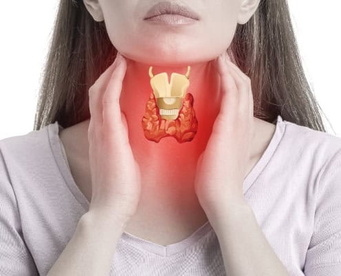 Mujer sujetándose la tiroides, que parece inflamada