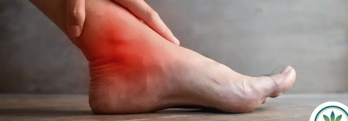 Pie con inflamación y dolor en el tobillo.