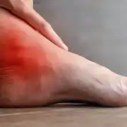 the-real-cbd-blog-CBD-para-la-FMF Pie con inflamación y dolor en el tobillo.