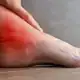 Pie con inflamación y dolor en el tobillo.