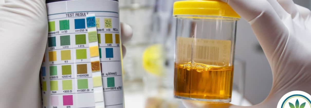 Kit de análisis de orina y una muestra de orina