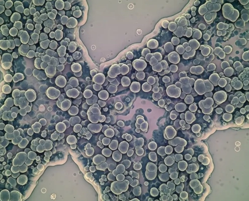 Infección por hongos vista a través de un microscopio.