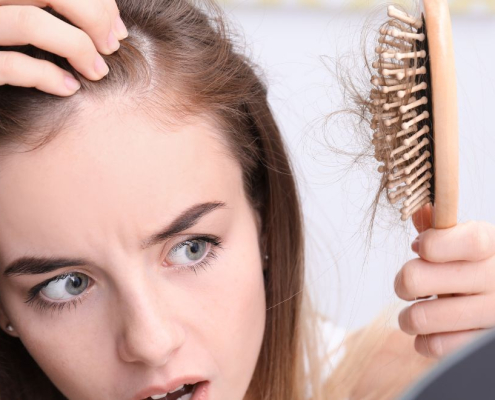 Una mujer que parece asustada al ver su cepillo lleno de pelo y la calva que tiene en la frente