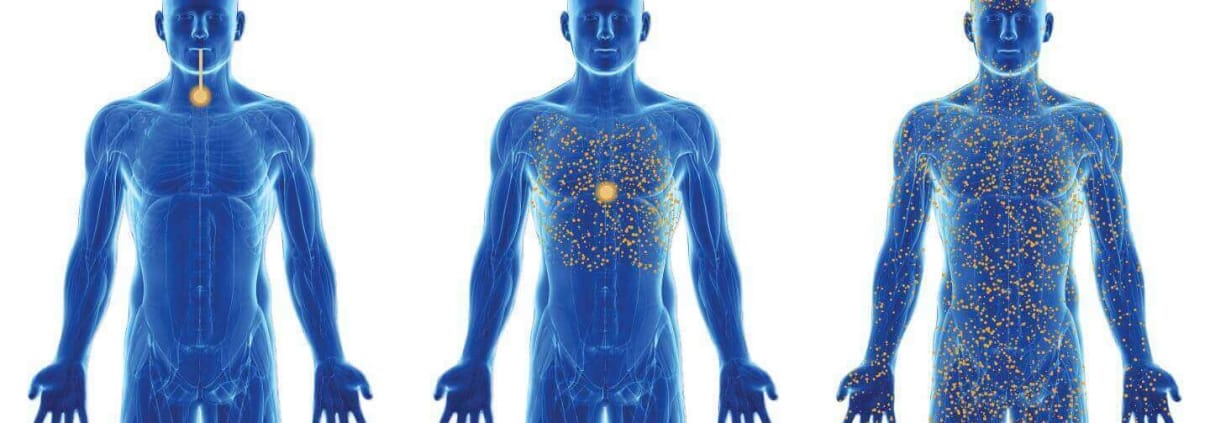 Illustration de 3 hommes bleus avec une biodisponibilité différente
