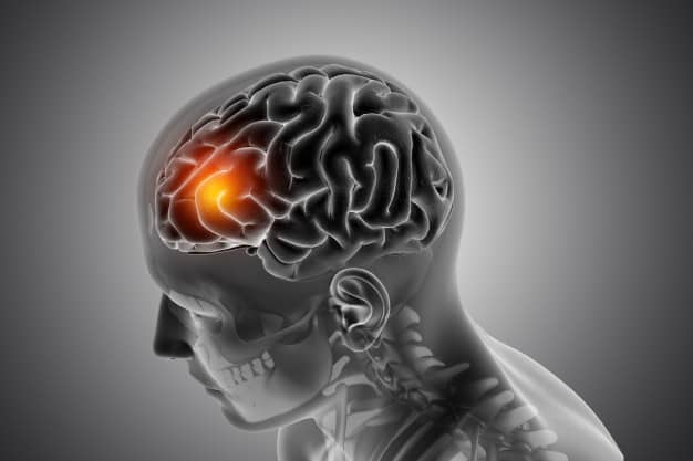 the-real-cbd-blog-cbd-for-dementia-brain