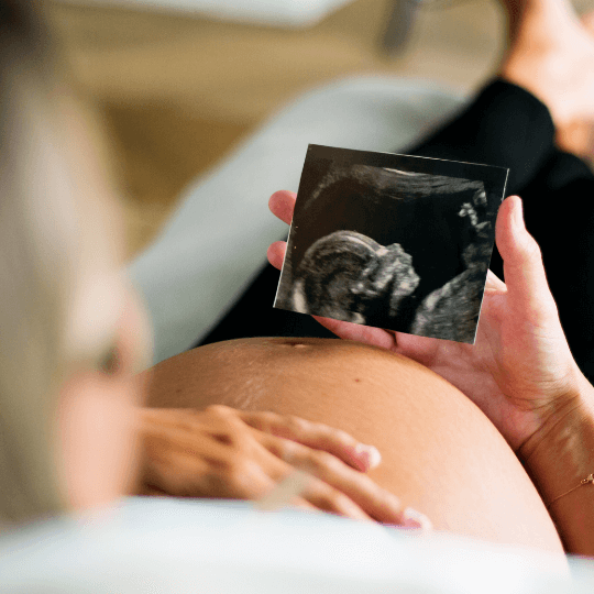 Pregnant woman holding her scan picture over her stomach