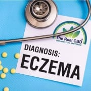 Der-Real-CBD-Blog-CBD-für-Ekzeme (1) (1) Ekzem auf dem Tisch eines Arztes mit Stethoskop und Tabletten