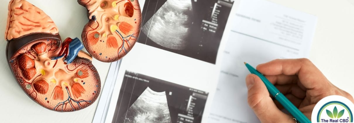 Scannen von Bildern von Nieren mit Nierenmodellen aus Kunststoff an der Seite