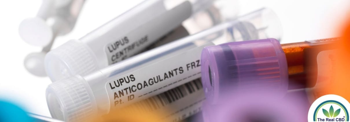 Lupus virale testbuisjes