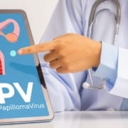 Der-Real-CBD-Blog-CBd-Öl-für-HPV-Virus Arzt zeigt auf Tablette mit HPV-Uterus darauf