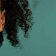 Farbige Frau mit Vitiligo-Flecken auf ihrer Haut im Gesicht