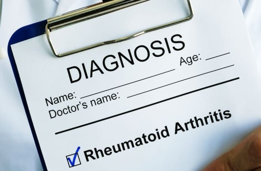 Médecin tenant un tableau à pince sur lequel figure le diagnostic de la polyarthrite rhumatoïde