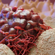 The-Real-CBD-Blog-CBd-for-pancratic-cancer Nahaufnahme einer roten Krebszelle
