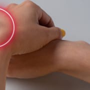 The-Real-CBD-CBD-for-lipoma Crossed hands with a lipoma on the wrist