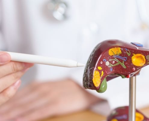 Arzt erklärt einem Patienten Hepatitis anhand eines Plastiklebermodells