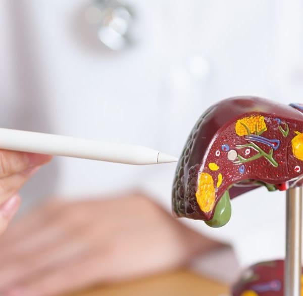 Arts legt hepatitis uit aan een patiรซnt met een plastic levermodel