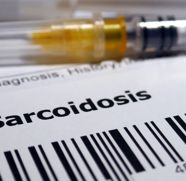 Spuit en artsenrapport over sarcoรฏdose
