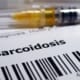 Spuit en artsenrapport over sarcoïdose
